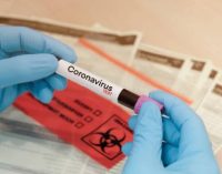 4148 нафар зери назорати табибон қарор доранд