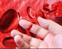 Табобати гемофилия