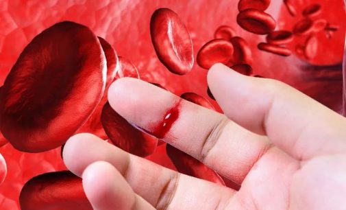 Табобати гемофилия