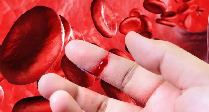 Табобати гемофилия