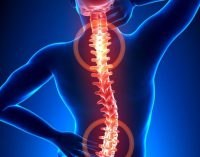 Остеохондроз. Беморие, ки 85% -и аҳолии курраи заминро азият медиҳад
