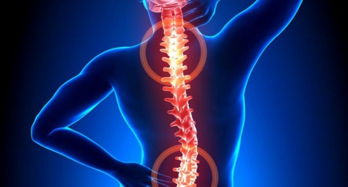 Остеохондроз. Беморие, ки 85% -и аҳолии курраи заминро азият медиҳад