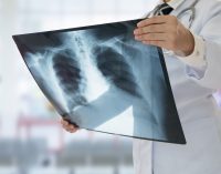 СИЛ: Донистани ҳуқуқҳои худ ба манфиати бемор аст